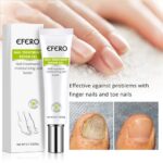 Fungal Removal Nail Treatment